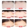 10 Pcs Forehead Wrinkle Patches,Facial Anti Wrinkle Patches, Reusable Face