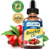 Aceite De Rosa Mosqueta Con Vitaminas A, C Y E