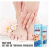 Tt/ Crema Fungicida Para Hongos En Uñas Y Piel De