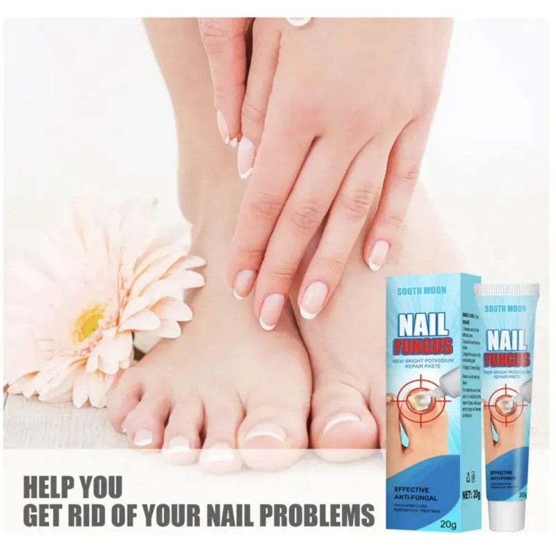 Tt/ Crema Fungicida Para Hongos En Uñas Y Piel De
