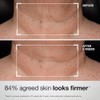 StriVectin TL Advanced Loción Reafirmante para Cuello y Escote con