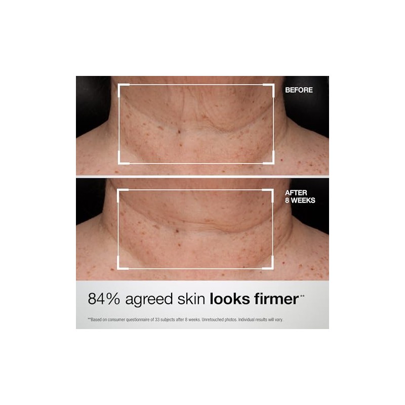 StriVectin TL Advanced Loción Reafirmante para Cuello y Escote con