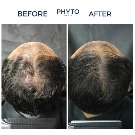 Phyto PHYTOCYANE Densifying Treatment for Progressive Hair Thinning - Men