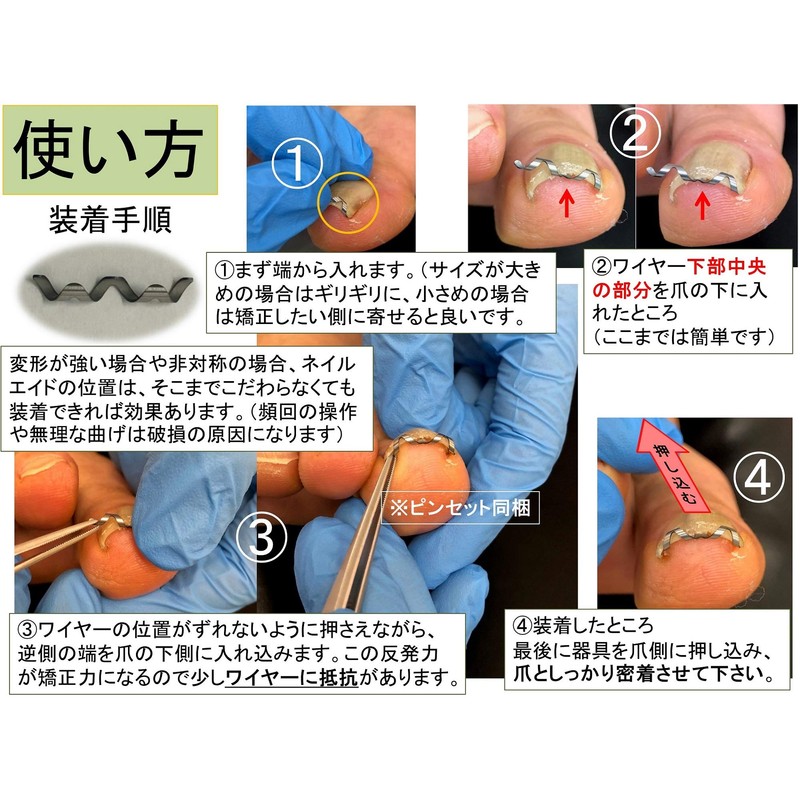 Nail Aid 0.6 inch (14 mm) Winding Nail Correction Self-Winding