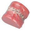 Demonstration Orthodontics Dental Model Disassembled Resin Teeth Model for Teaching