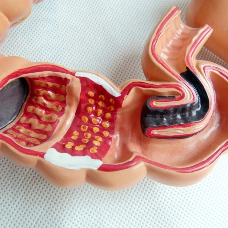 Modelo Didáctico, Modelo De Anatomía Visceral Del Intestino
