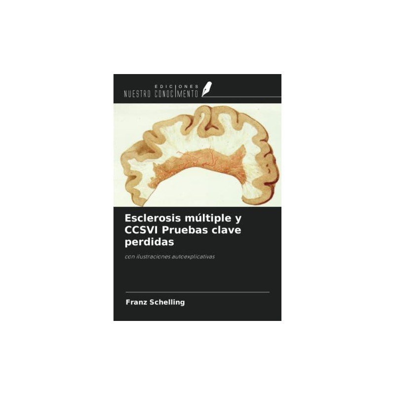 Esclerosis múltiple y CCSVI Pruebas clave perdidas: con ilustraciones autoexplicativas