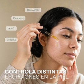 Aceite de Caléndula 50 ml | Calma Piel Sensible y Reactiva | Cicatrizante Antiinflamatorio | Antiacné Antioxidante | para Rostro Cuerpo Cabello y Masa
