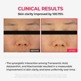 Dr.Melaxin TX Astaxanthin Overnight Wrapping Peel-Off Mask – Skin Tone Improving, Hydrating & Firming Overnight Face Mask for Glow & Texture Refinement