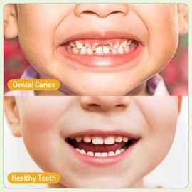 Pego Espray Bucal Niños Limpia Dientes Suavidad Refresca Aliento Instante Tamaño Bolsillo Transportarlo Fácilmente Paquete Color Uva