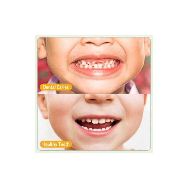Pego Espray Bucal Niños Limpia Dientes Suavidad Refresca Aliento Instante