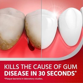 Corsodyl Mint Flavour Mouthwash,  600ml Specially Designed Benefits for Stop and Prevent Bleeding Gums, Irritated Gums, Mouth Ulcers