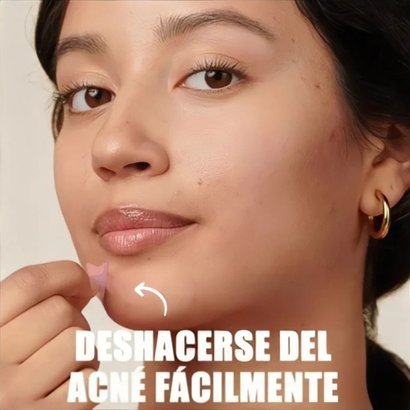 280pzs Mascarillas Estrella Acne