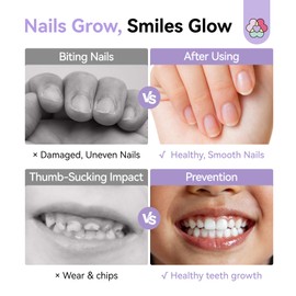 SAVILAND Nail Biting Prevention Extreme Bitter 0.51 oz/15ml: Stop Biting Nail 72H Lasting Nail Biting Treatment& Nails Care Strength Natural Repair for Damaged Nails With Marigold & Aloe Vera