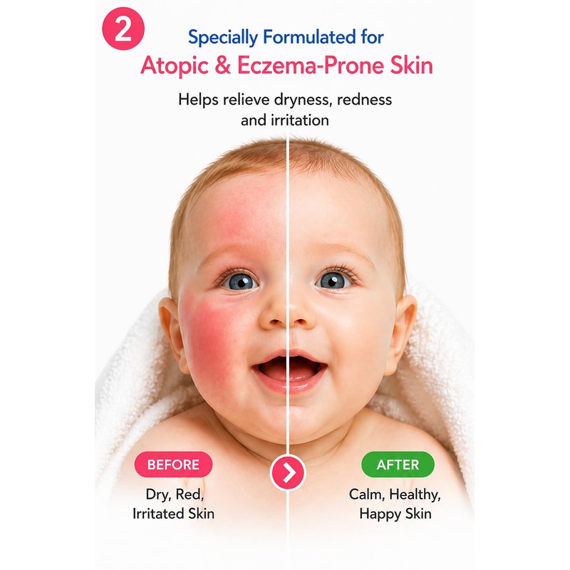 Babyton Atopic Skin Shampoo for Babies 400ml – Gentle, Natural