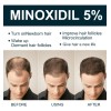 Tratamiento Para Cabello Y Barba Para El Crecimiento Del Cab