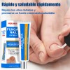 Crema Fúngica Uñas Tolnaftato 1%, Hongos En Uñas Infeccion