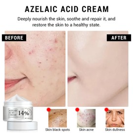 Asheyya Azelaic Acid Cream, Face Serum Skin Care Beauty with Niacinamide & Vitamin C
