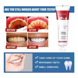 Pasta De Dientes Sp-4 Con Probióticos Blanqueadores