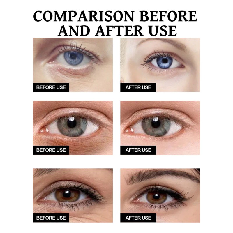 Crema De Péptidos Firmes Para El Endurecimiento De Ojos X,