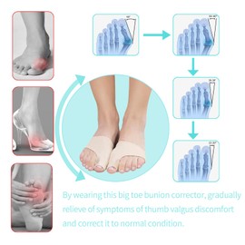 XREKNOi Bunion Relief Sleeve For Men and Women,Bunion Brace Big Toe Corrector Socks with Gel Bunion Pad for Hallux Valgus Foot Toe Sepaprator Bunion Corrector Pack (S(Foot Size 5-8))