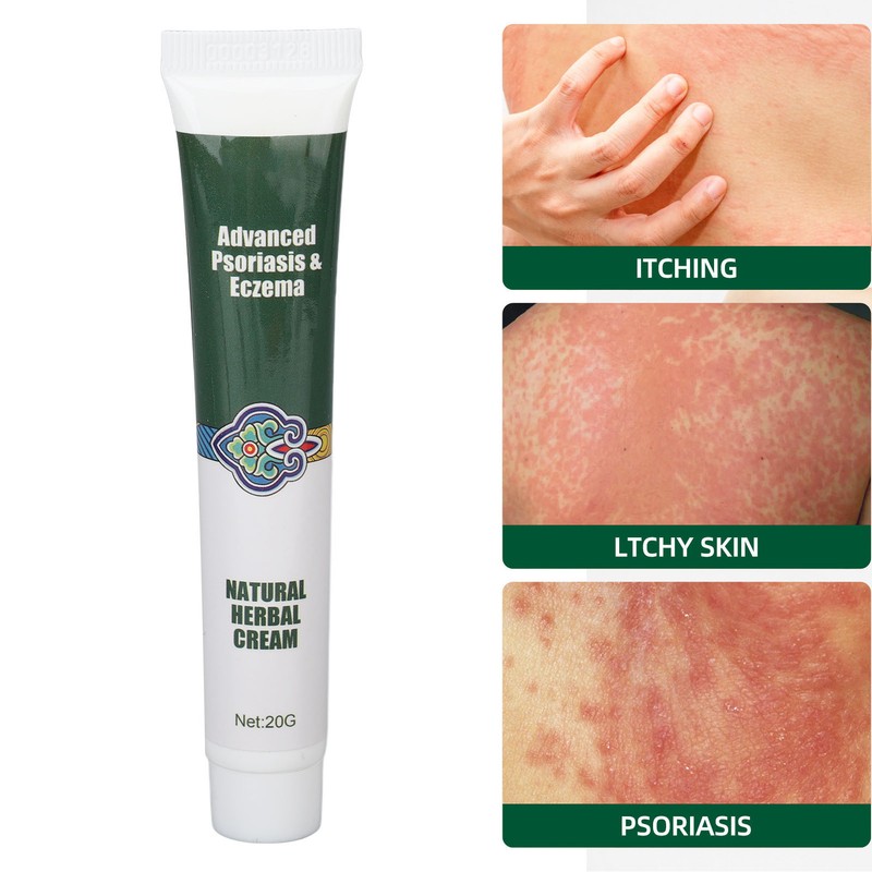 2pcs Hydrating Moisturizing Cream Eczema Erythema Repair Cream Itchy Skin