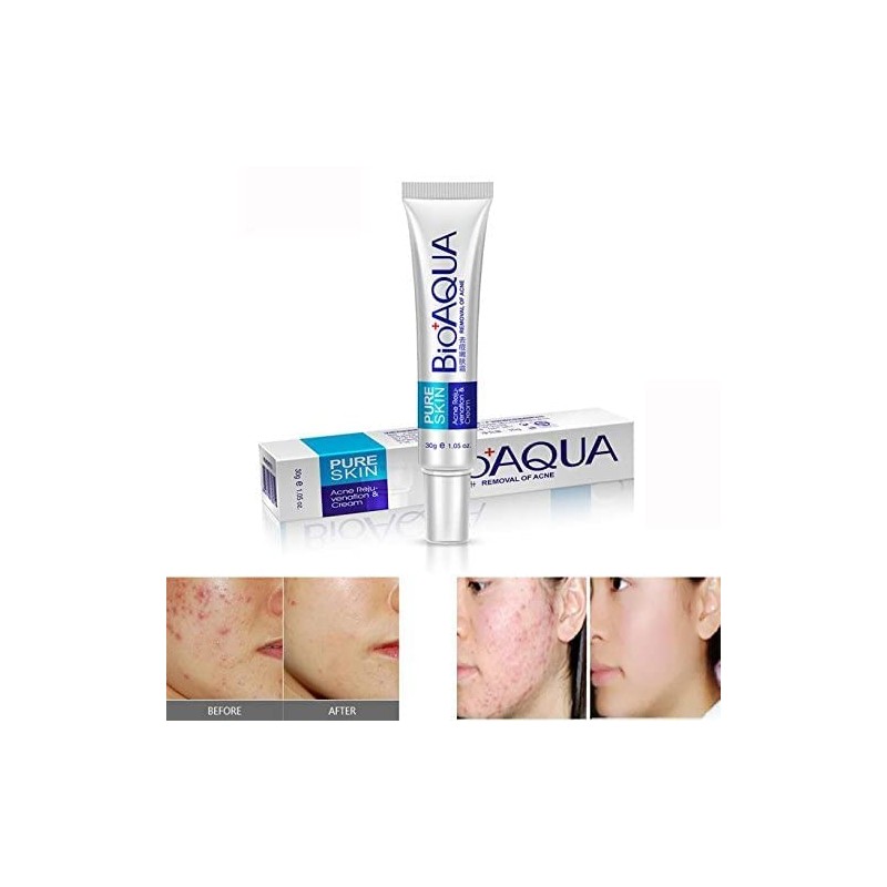 Bioaqua Crema Pure Skin Elimina Acné y Cicatrices Control De