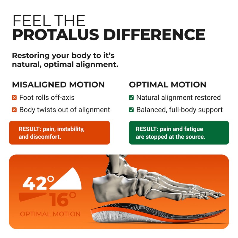 Protalus M-100 Lite Insoles – Patented Alignment Technology for Over-Pronation,