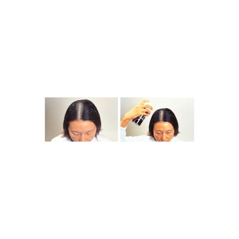 Thin Hair 地肌 to Cover for a of Black Hair