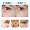 Boosting Eye Cream for Anti Aging - Eye Cream for