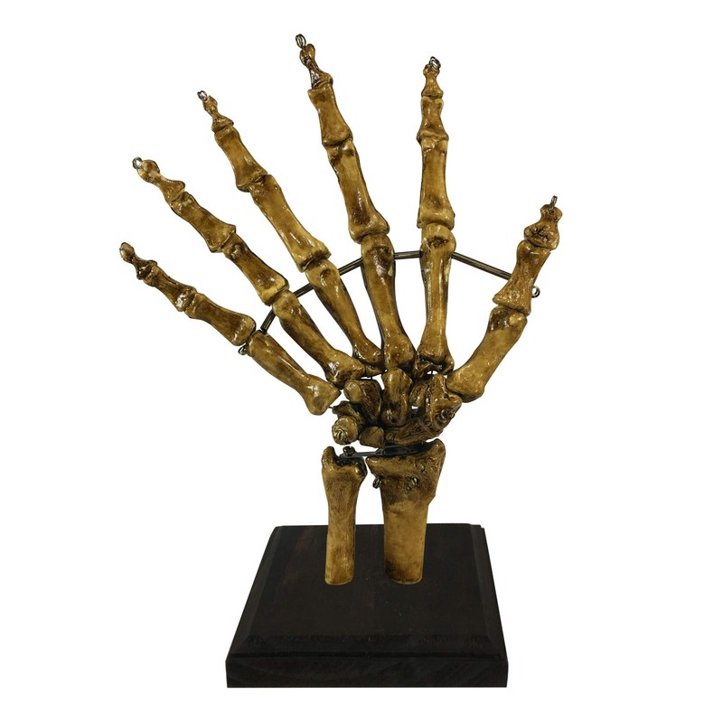 Asylum Zone Bizarre! Vintage 6 Finger Skeleton Hand Oddity Medical