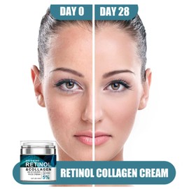 Retinol-Feuchtigkeitscreme – Anti-Aging-Gesichtscreme für strahlende Haut, hellere Pigmentflecken & gleichmäßigen Teint. Tagescreme & Nachtcreme mit Retinol für Frauen und Männer