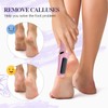 Nuve Smooth Pedicure Wand, Electric Callus Removers for Feet Rechargeable,