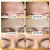 Jakuva 24K Gold Forehead Wrinkle Patches for Face-Hydrogel Pads with