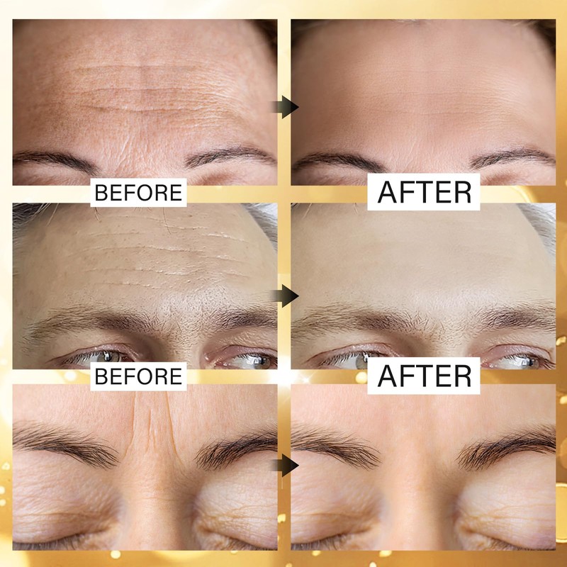 Jakuva 24K Gold Forehead Wrinkle Patches for Face-Hydrogel Pads with