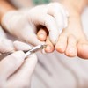 Toenail Clipper, Professional Stainless Steel Nail Clipper Ingrown Toenail Tool