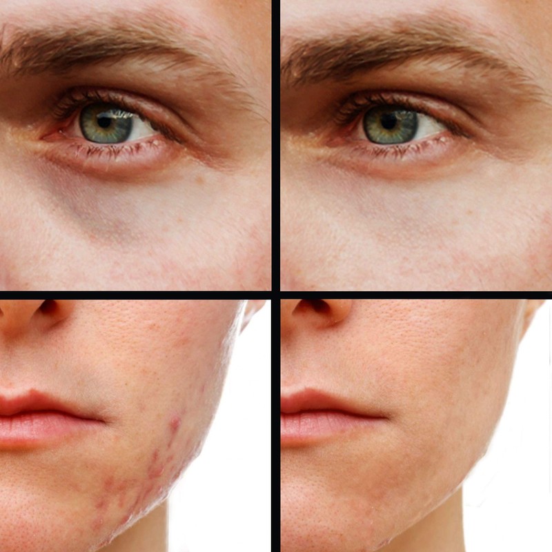 KODE Mens Concealer (Lightest) – Dark Circle Under Eye Cream