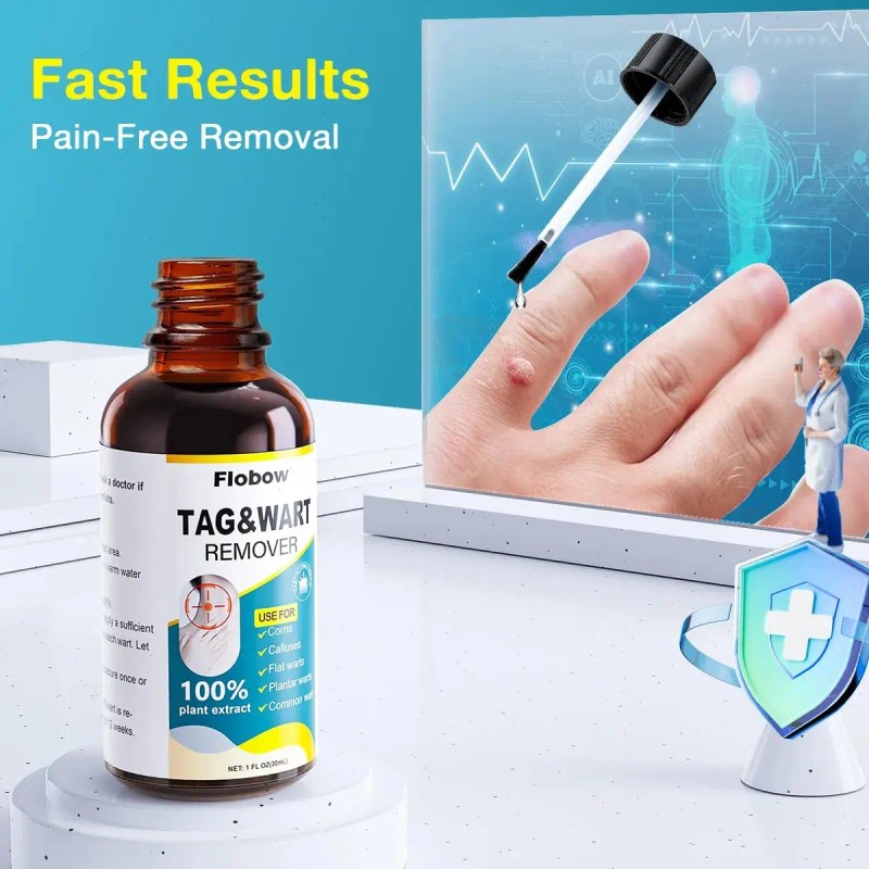 Líquido Para Verrugas 30 Ml - Eliminación Rápida