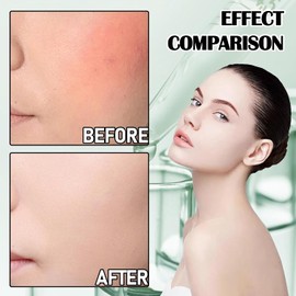8 Piezas De Gel De Aloe Vera Orgánico Para El Cuidado De La Piel Después Del Sol, Gel Hidratante Natural De Aloe Vera Para Rostro Y Cuerpo, Humectante Facial Fácil A Portátil,