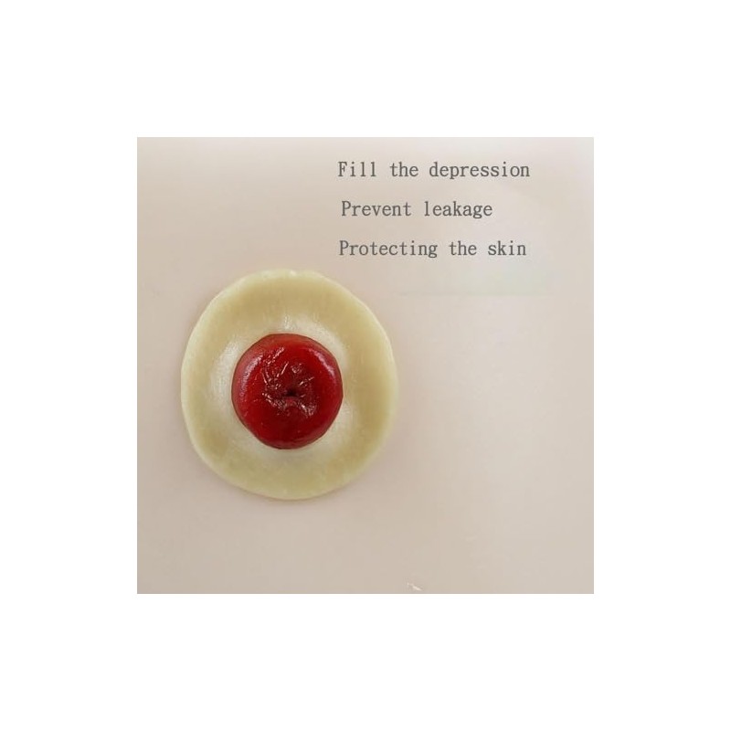 20 PCS Ostomy Barrier Rings No Leaking Barrier Extenders for