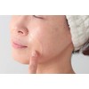 COCORO PLACENTA Ping Ping Eyes Gel Pack for Eyes and