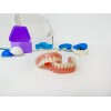 RenewaSmile DIY FULL DENTURES for beginners (ONE SIZE FITS ALL)