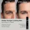 Anthony High Performance Vitamin A, Anti Aging, Facial Treatment, 1.6