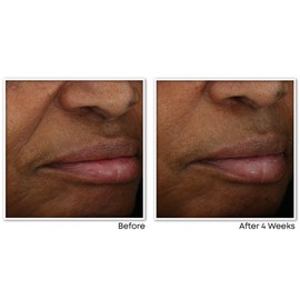 RoC RoC Multi Correxion? Revive + Glow 10% Vitamin C Blend Face Moisturizer, Anti-Aging Gel Cream for Instant Glow, Hypo-Allegenic & Oil-Free Skin Care, 50ML