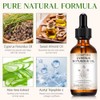 GOGIFTGO Aceite De Cyperus Rotundus Aceite De Cyperus Aceite De