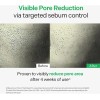 Sérum Torriden Balanceful Control Sebum 50 Ml