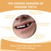 Partial Dentures - Dentures for Missing Teeth & Gaps -
