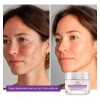 Crema Despigmentante Para Manchas, Melasma, Acné Y Paño 50g