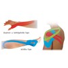 Höga-K-Tape-Silk Kinesiology Tape in Silk Quality 5 cm x 5