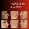 Crema Facial Despigmentante Y Aclarante 20g Todo Tipo De Piel